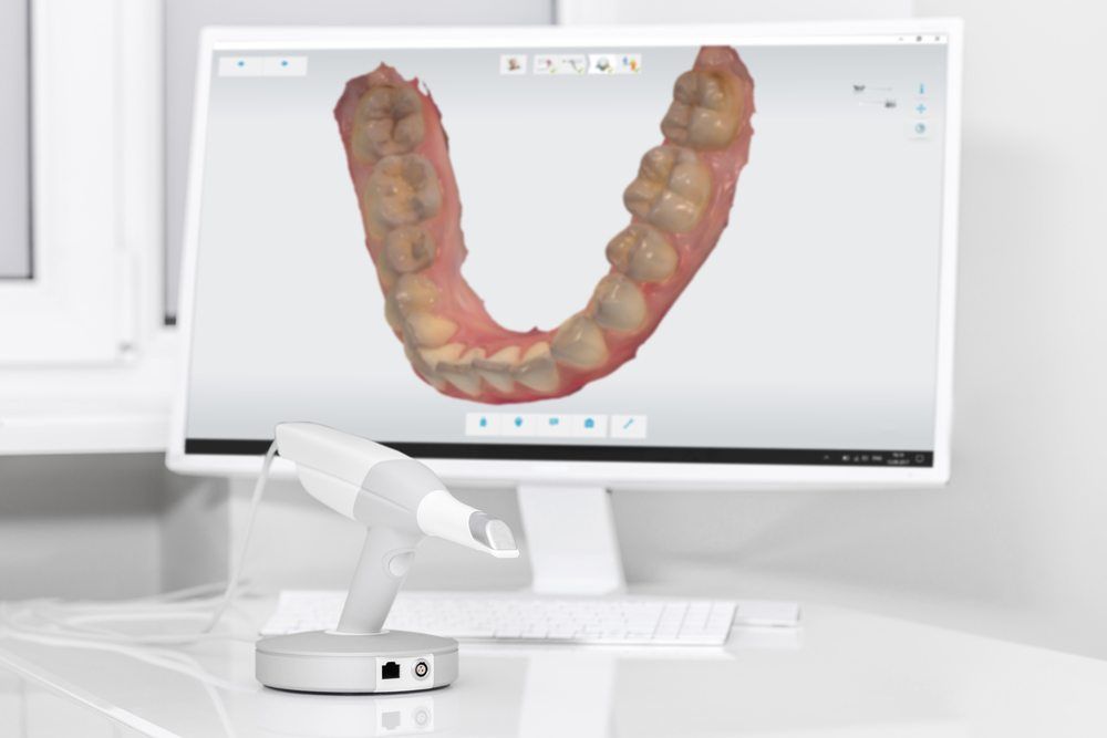 intraoralscanner » New York, NY Dentistry Dr. Lee Delaire Dental